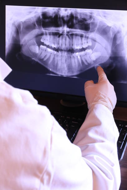 Best Emergency Root Canal Treatment in North Tunica, MS