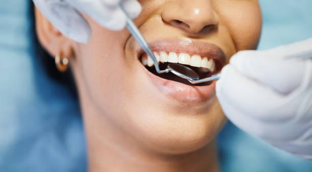 Best Emergency Dental Care for Abscessed Tooth in North Tunica, MS